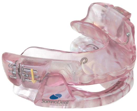 Sleep apnea oral appliance