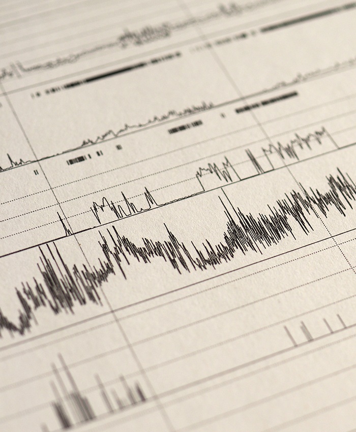 Diganostic results of at home sleep test