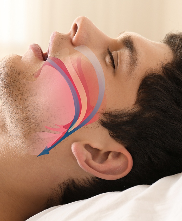 Sleeping man with animated airway across his profile