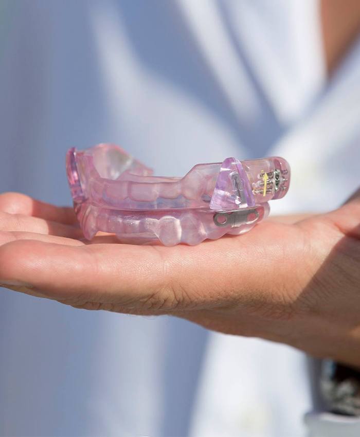 SomnoMed sleep apnea oral appliance